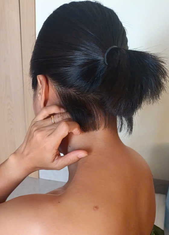 Bấm huyệt Phong Trì ở sau gáy để giảm đau cổ vai gáy
